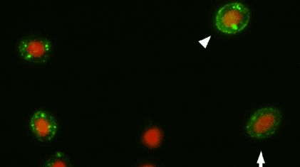 PRV – Immunfluorescence mikroskopi